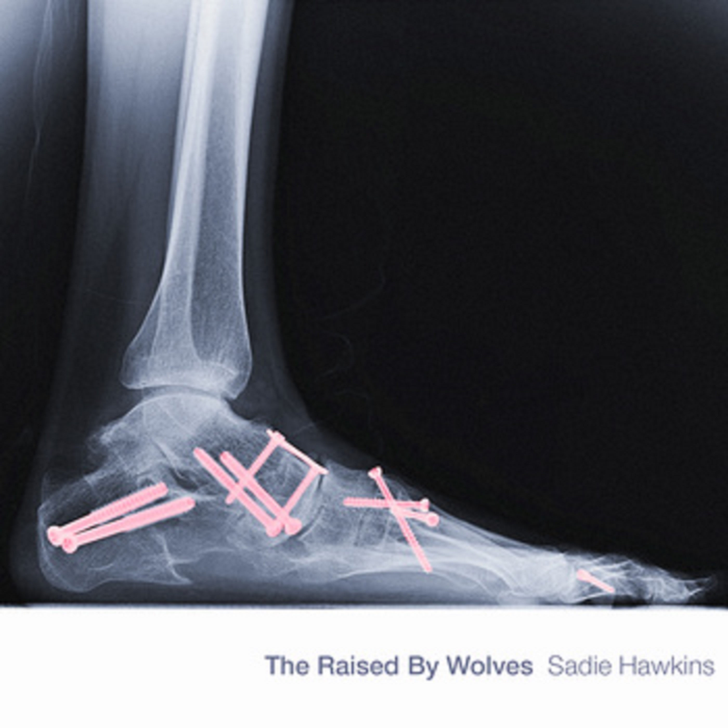The Raised by Wolves | Sadie Hawkins | Review