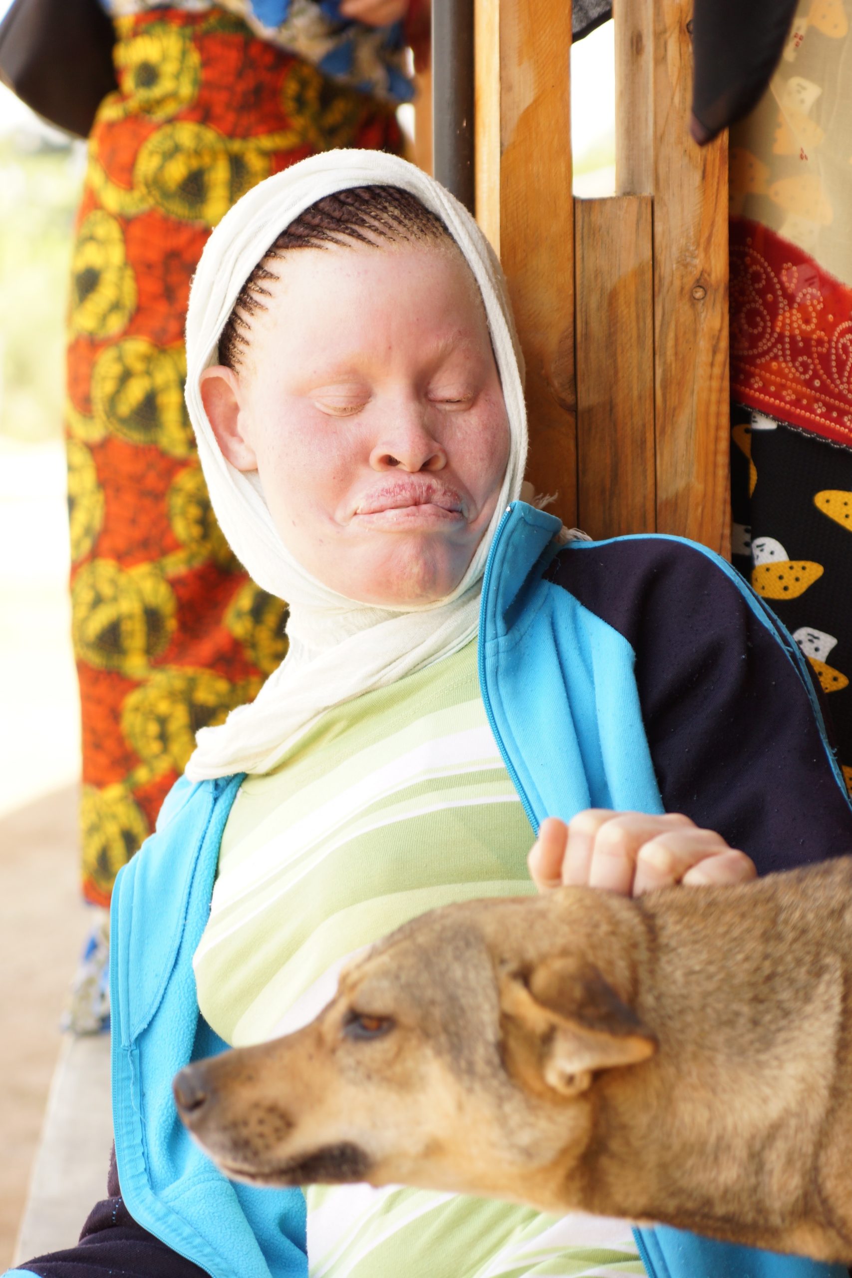 Tanzania Albinism Collective Release New Single In Celebration of International Albinism Awareness Day