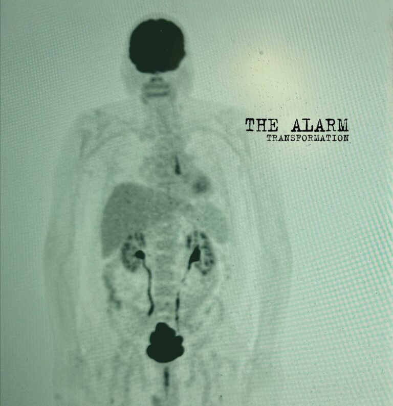 The Alarm Honor Mike Peters with Final Album Transformation and “Live Today”
